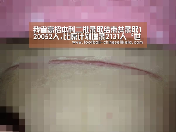 我省高招本科二批录取结束共录取120052人,比原计划增录2131人‘世界杯买球网站’(图1) 世界杯买球